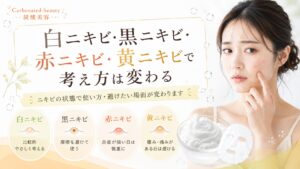 白ニキビ・黒ニキビ・赤ニキビ・黄ニキビで考え方は変わる